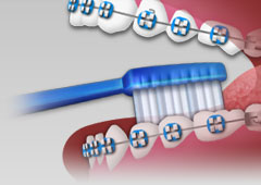 Brushing 4 Brushing 4