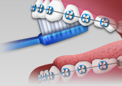 Brushing 5 Brushing 5