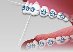 Flossing 3 Flossing 3