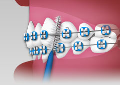 Interdental Interdental
