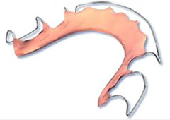 Retainer Retainer